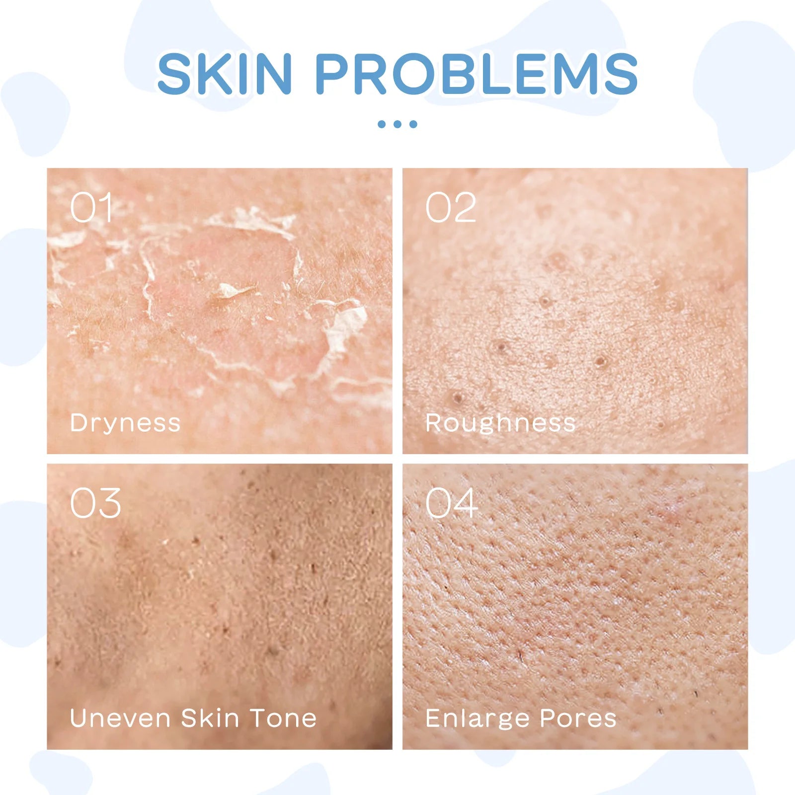 LAIKOU Milk Skincare Set