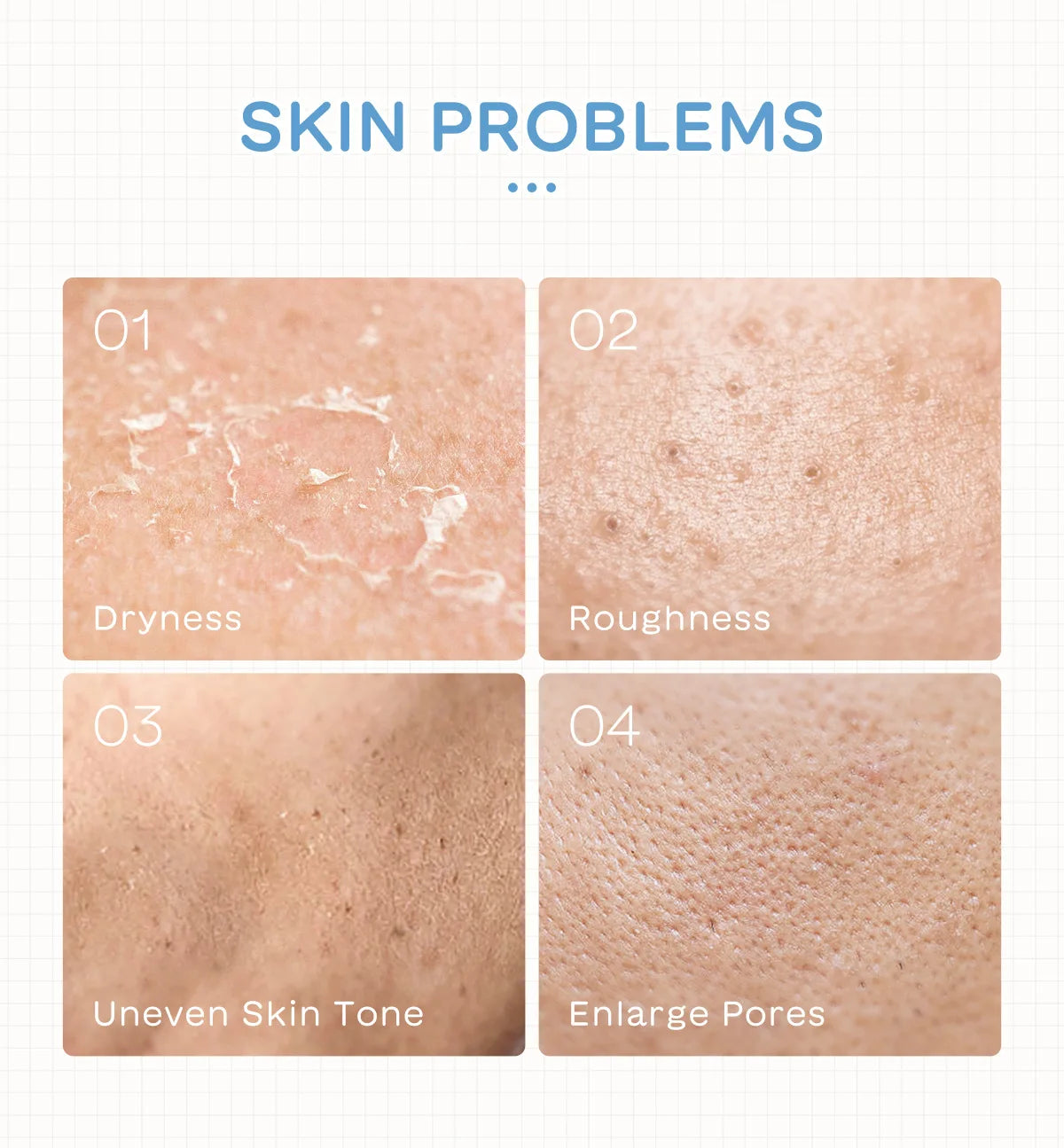 LAIKOU Milk Skincare Set